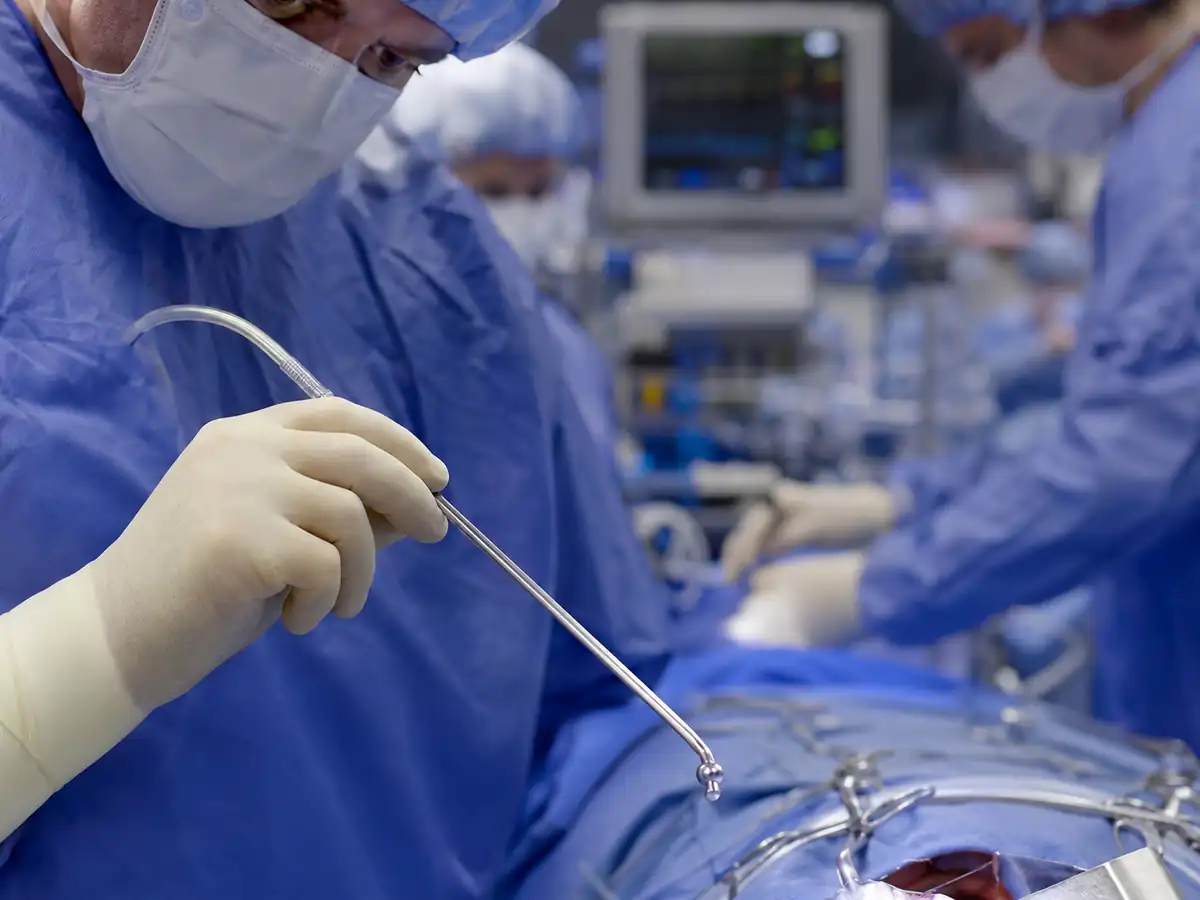 Cardiothoracic surgical team in an operating room